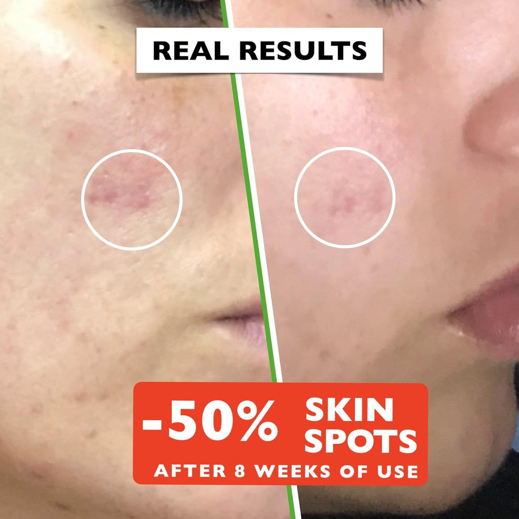 Big 2.11oz. Organic Vitamin C Serum for Face. Anti-Dark Spots, Wrinkles Skin Repair Serum with Hyaluronic Acid, Vitamin C & Niacinamide. All-in-One Brightening, Anti Aging Facial & Eye Area Skincare